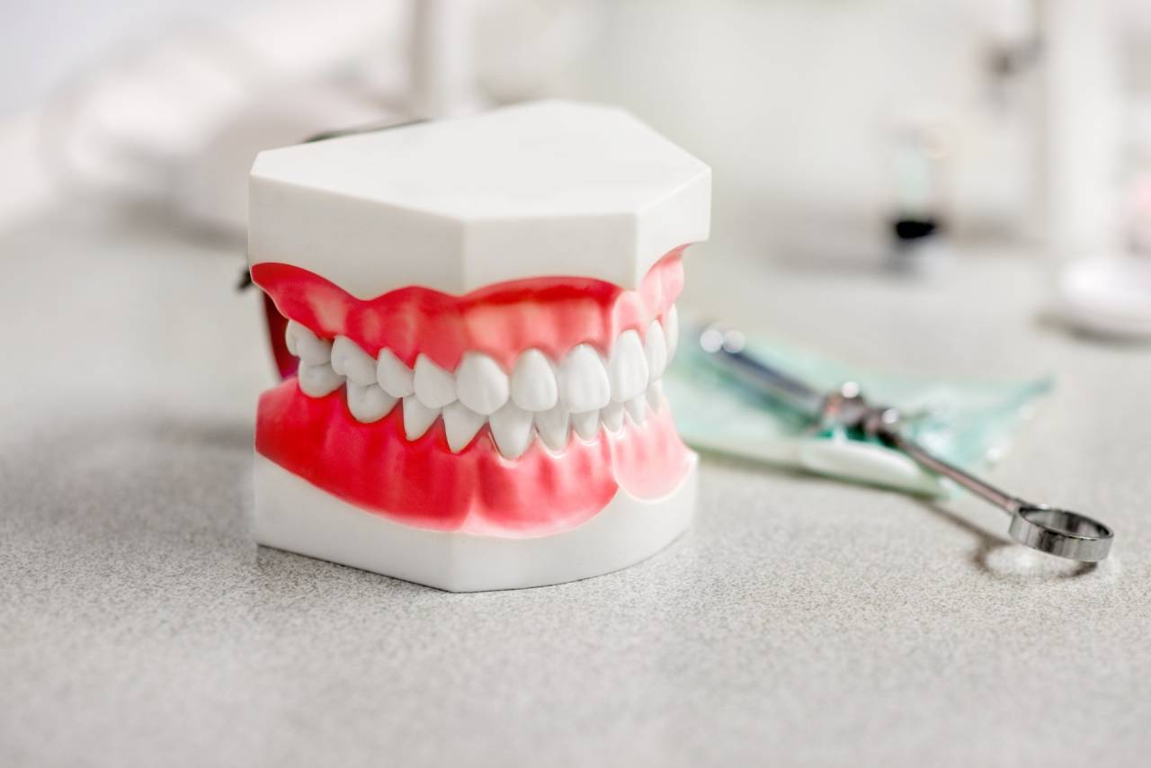 虫歯を繰り返さないための予防歯科